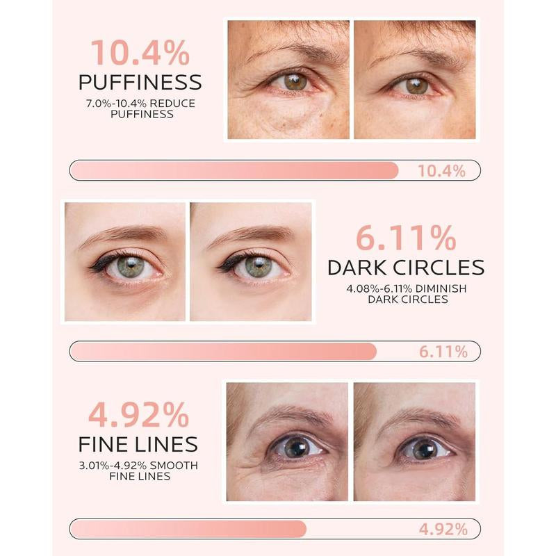 Under Eye Patches for Puffiness: Dark Circles and Puffy Eyes Treatment Caffeine Eye Mask with Niacinamide Hyaluronic Acid - Smooth Wrinkles Reduce Eye Bags Undereye Gel Pad (30 Pairs)